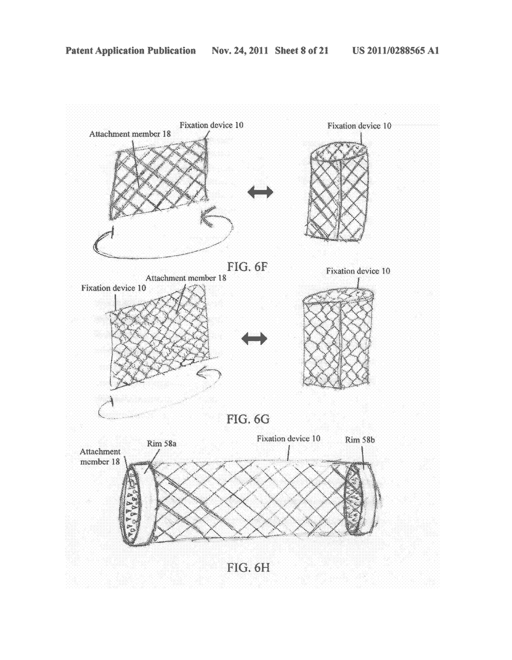 TISSUE FIXATION - diagram, schematic, and image 09