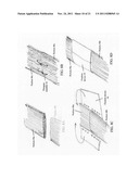 TISSUE FIXATION diagram and image