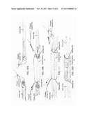 TISSUE FIXATION diagram and image