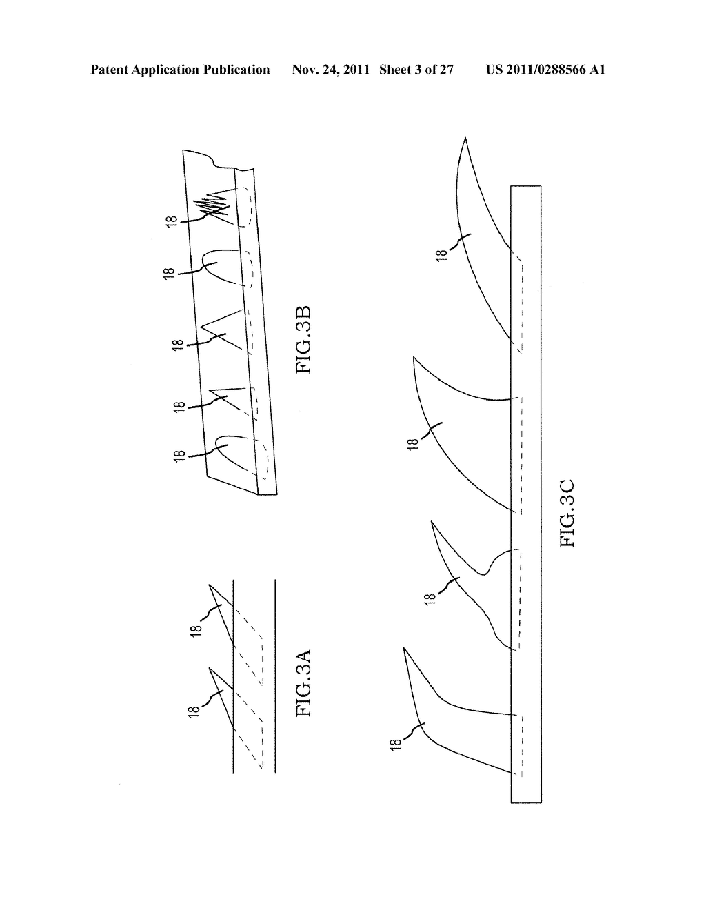 TISSUE STABILIZATION SYSTEM - diagram, schematic, and image 04