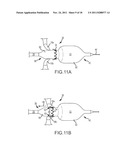 APPARATUS AND METHOD FOR JOINING ADJACENT TISSUE diagram and image