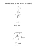 APPARATUS AND METHOD FOR JOINING ADJACENT TISSUE diagram and image