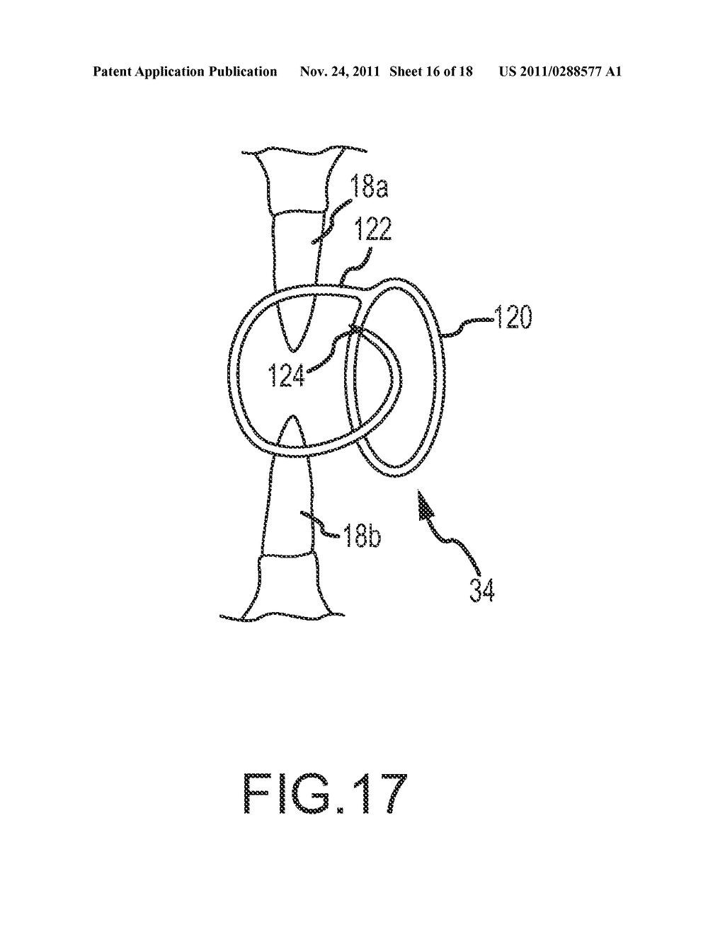 APPARATUS AND METHOD FOR JOINING ADJACENT TISSUE - diagram, schematic, and image 17