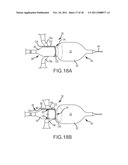 APPARATUS AND METHOD FOR JOINING ADJACENT TISSUE diagram and image