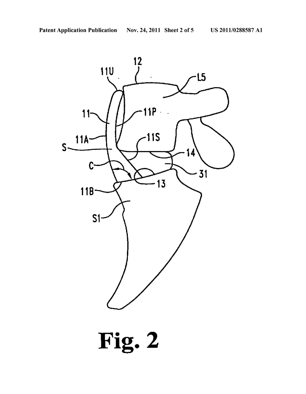 ANTERIOR LUMBAR PLATE AND METHOD - diagram, schematic, and image 03