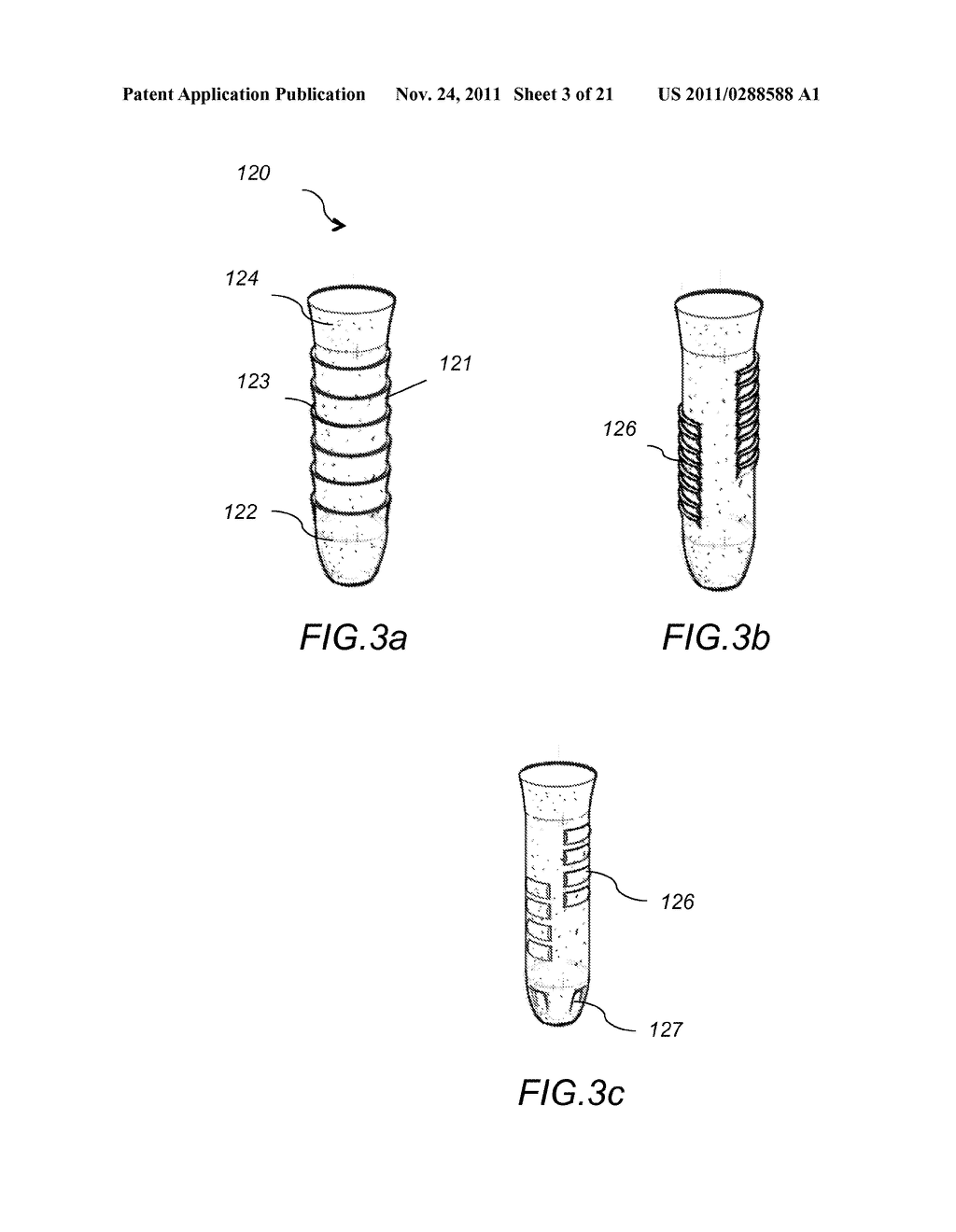 SYSTEM AND METHOD FOR FACET FIXATION AND FUSION - diagram, schematic, and image 04