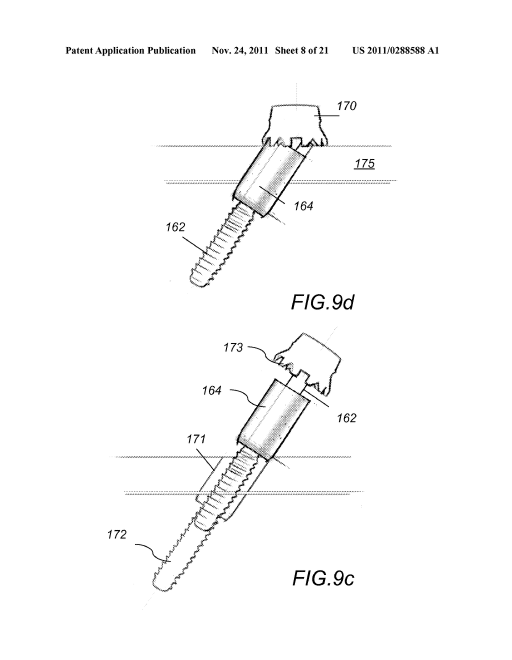 SYSTEM AND METHOD FOR FACET FIXATION AND FUSION - diagram, schematic, and image 09