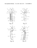 Method and Apparatus for Performing Spinal Fusion Surgery diagram and image