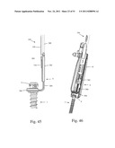 Method and Apparatus for Performing Spinal Fusion Surgery diagram and image