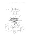 Method and Apparatus for Performing Spinal Fusion Surgery diagram and image