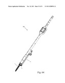 Method and Apparatus for Performing Spinal Fusion Surgery diagram and image