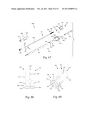 Method and Apparatus for Performing Spinal Fusion Surgery diagram and image