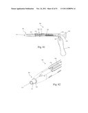 Method and Apparatus for Performing Spinal Fusion Surgery diagram and image