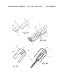 Method and Apparatus for Performing Spinal Fusion Surgery diagram and image