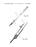 Method and Apparatus for Performing Spinal Fusion Surgery diagram and image