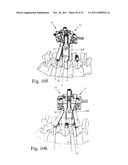 Method and Apparatus for Performing Spinal Fusion Surgery diagram and image