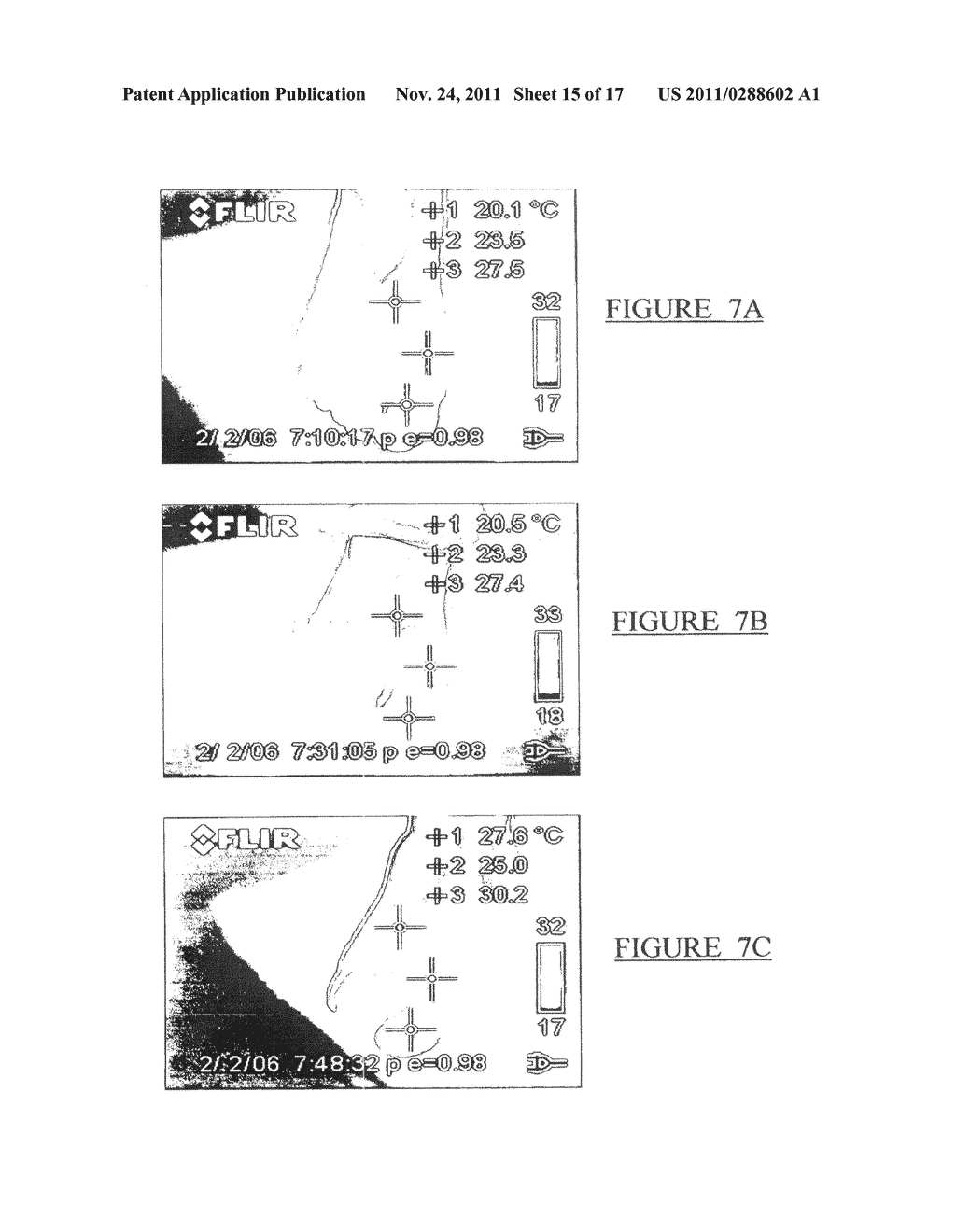 Method and Device for Enhanced Blood Flow - diagram, schematic, and image 16