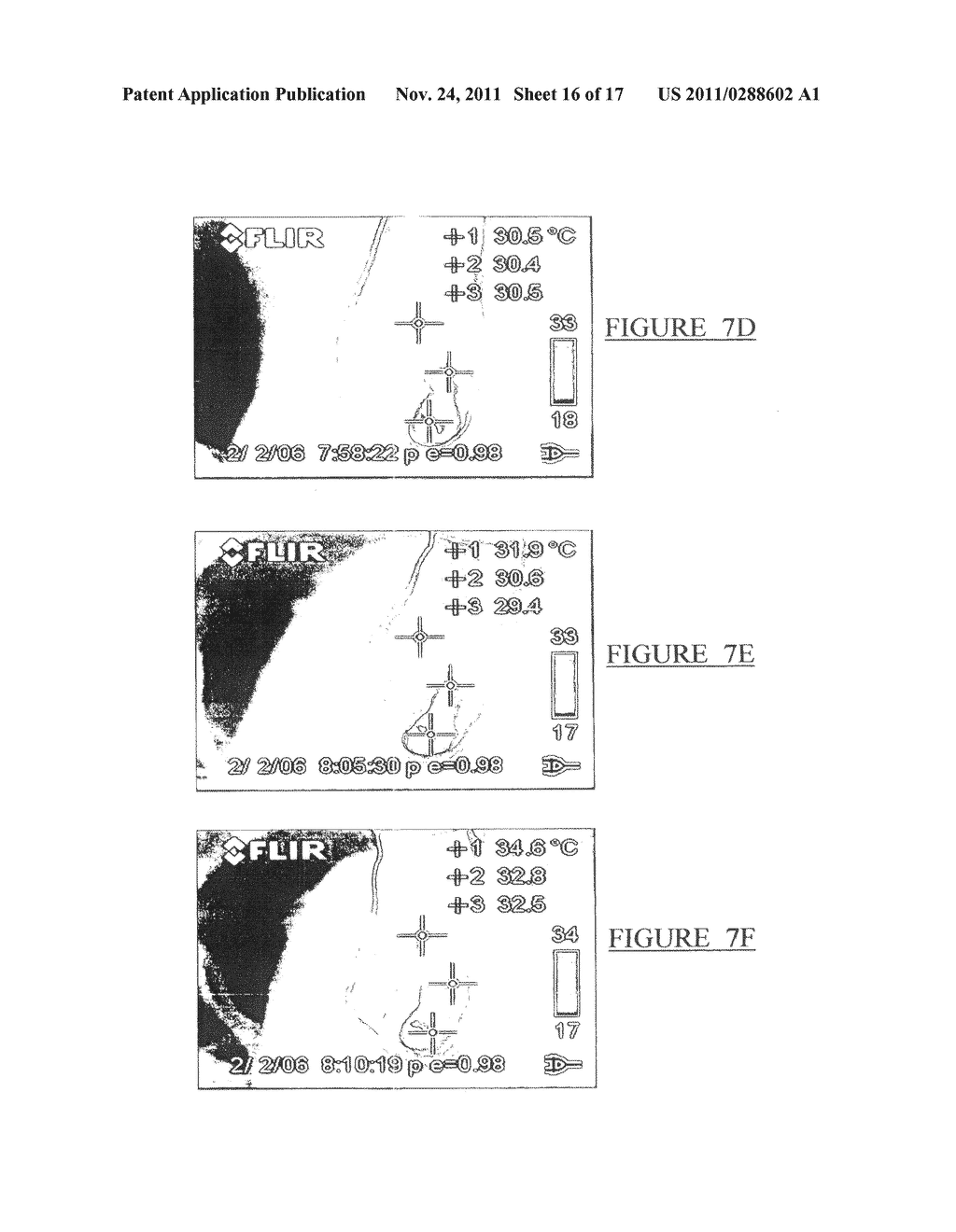 Method and Device for Enhanced Blood Flow - diagram, schematic, and image 17