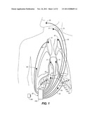 THERAPEUTIC DIAPHRAGM STIMULATION DEVICE AND METHOD diagram and image