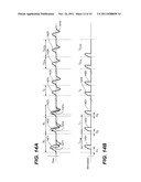 THERAPEUTIC DIAPHRAGM STIMULATION DEVICE AND METHOD diagram and image