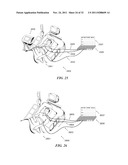 THERAPEUTIC DIAPHRAGM STIMULATION DEVICE AND METHOD diagram and image