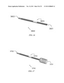 THERAPEUTIC DIAPHRAGM STIMULATION DEVICE AND METHOD diagram and image