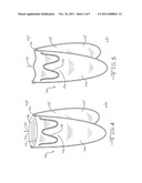 PROSTHETIC VALVE WITH EXTERNAL SUPPORT FRAME diagram and image