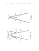 PROSTHETIC VALVE WITH EXTERNAL SUPPORT FRAME diagram and image