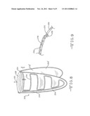 PROSTHETIC VALVE WITH EXTERNAL SUPPORT FRAME diagram and image