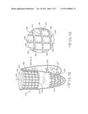 PROSTHETIC VALVE WITH EXTERNAL SUPPORT FRAME diagram and image