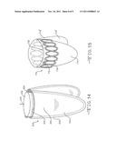 PROSTHETIC VALVE WITH EXTERNAL SUPPORT FRAME diagram and image