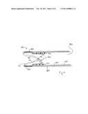 PROSTHETIC VALVE WITH EXTERNAL SUPPORT FRAME diagram and image