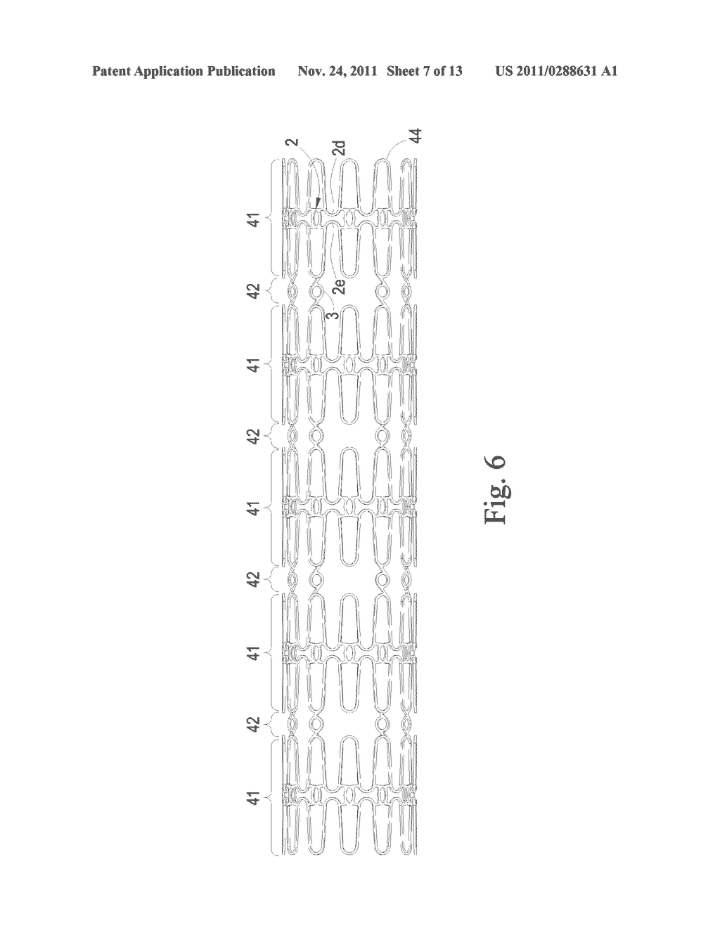 Preventing Vascular Stenosis of Cardiovascular Stent - diagram, schematic, and image 08