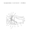 Method and Apparatus for Fixing a Graft in a Bone Tunnel diagram and image