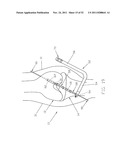 Method and Apparatus for Fixing a Graft in a Bone Tunnel diagram and image