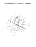 Method and Apparatus for Fixing a Graft in a Bone Tunnel diagram and image