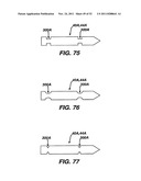 Method and Apparatus for Fixing a Graft in a Bone Tunnel diagram and image