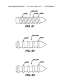 Method and Apparatus for Fixing a Graft in a Bone Tunnel diagram and image