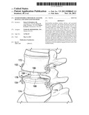 INTERVERTEBRAL PROSTHETIC SYSTEMS, DEVICES, AND ASSOCIATED METHODS diagram and image