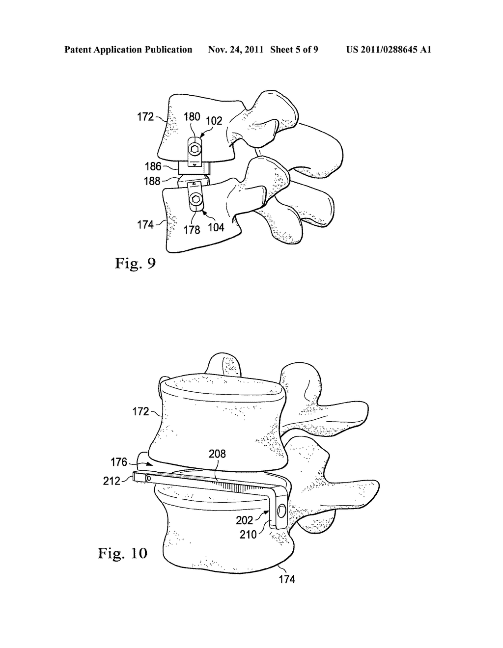 INTERVERTEBRAL PROSTHETIC SYSTEMS, DEVICES, AND ASSOCIATED METHODS - diagram, schematic, and image 06