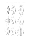 ILIAC CANAL PROSTHESIS diagram and image