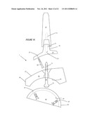 ILIAC CANAL PROSTHESIS diagram and image