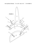 ILIAC CANAL PROSTHESIS diagram and image