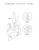 ILIAC CANAL PROSTHESIS diagram and image