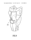 SWALLOW EXPANSION DEVICE diagram and image