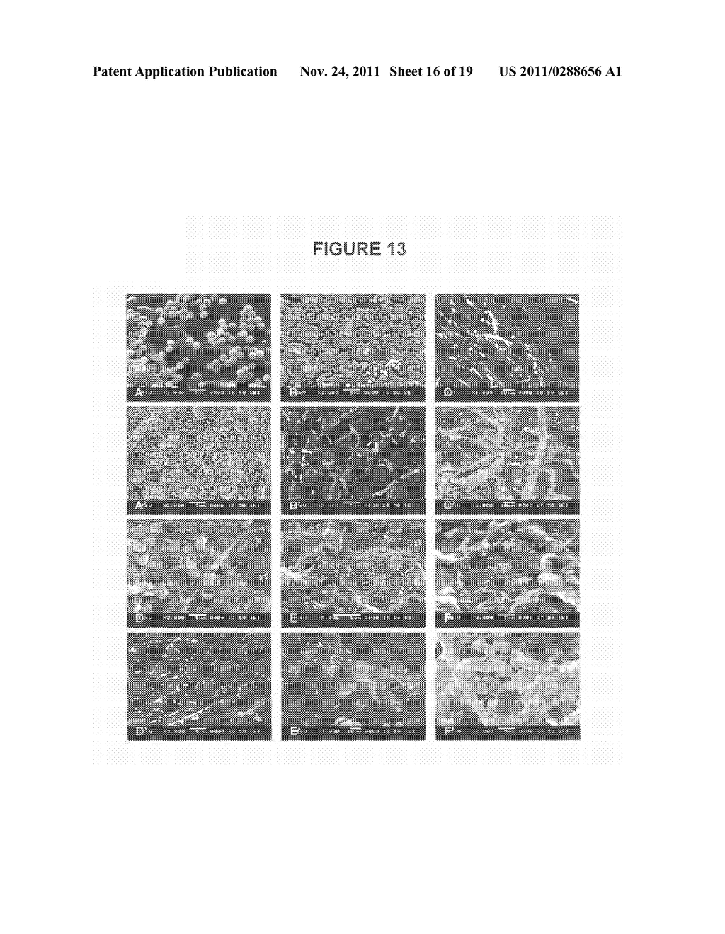 TISSUE GRAFT COMPOSITIONS AND METHODS FOR PRODUCING SAME - diagram, schematic, and image 17