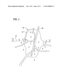 METHOD OF AND APPARATUS FOR APPLYING A PESTICIDE diagram and image