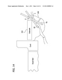 METHOD OF AND APPARATUS FOR APPLYING A PESTICIDE diagram and image