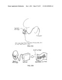 LAYERED NASAL RESPIRATORY DEVICES diagram and image