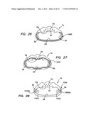 APPARATUS AND METHODS FOR TREATING SLEEP APNEA diagram and image